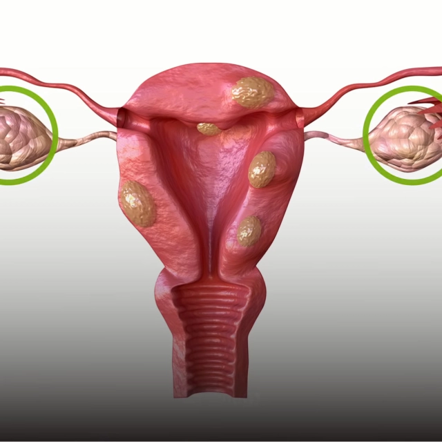 Dlouhé špinění po menstruaci